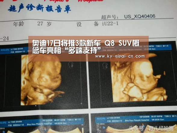 奥迪17日将推3款新车 Q8 SUV概念车亮相“多端支持”(图2) 使用教程